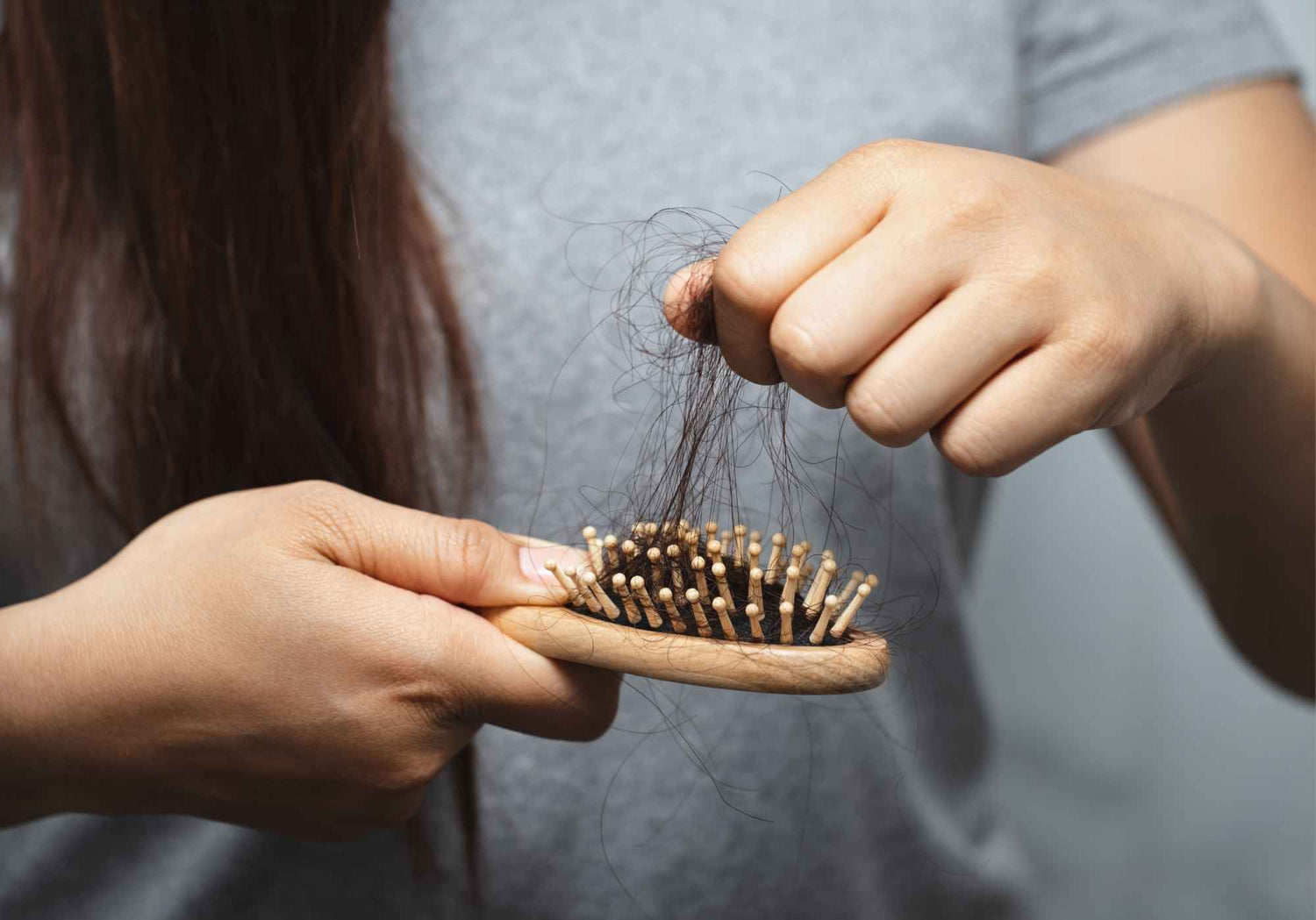 Chute de cheveux et alopécie : causes et solutions